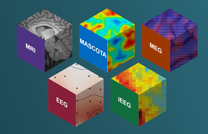 Imagen de la plataforma OpenNeuro